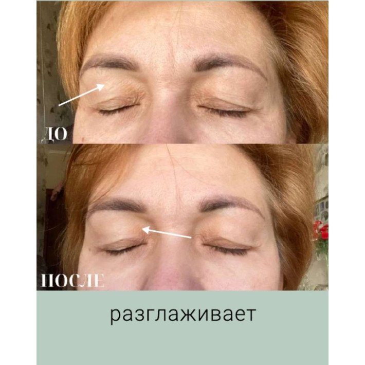 Бокс "Лифтинг" (9 продуктов) VIP НГ - ноябрь