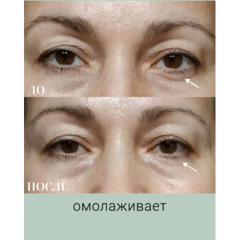 Бокс "Лифтинг" (9 продуктов) VIP НГ - ноябрь