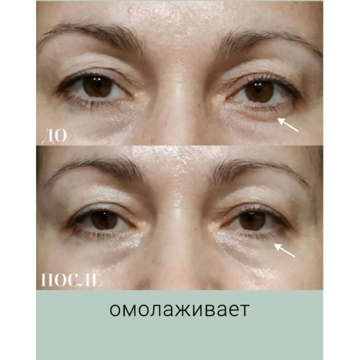 Бокс "Лифтинг" (9 продуктов) VIP НГ - ноябрь