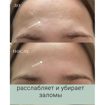 Бокс "Лифтинг" (9 продуктов) VIP НГ - ноябрь