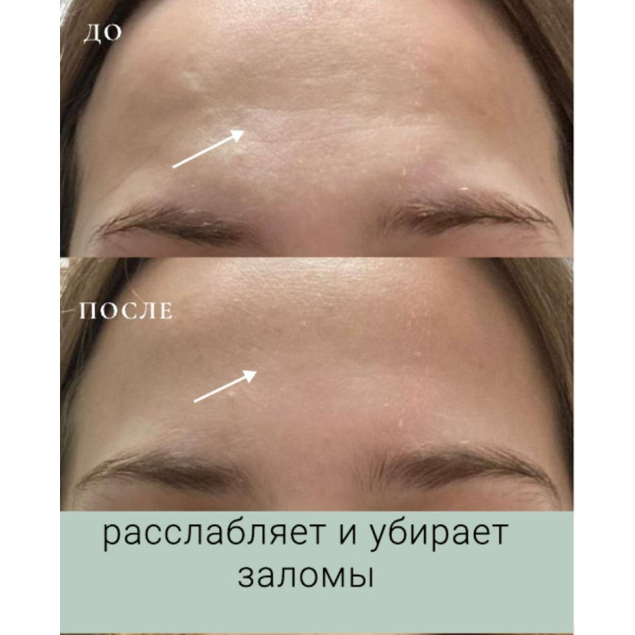 Бокс "Лифтинг" (9 продуктов) VIP НГ - ноябрь