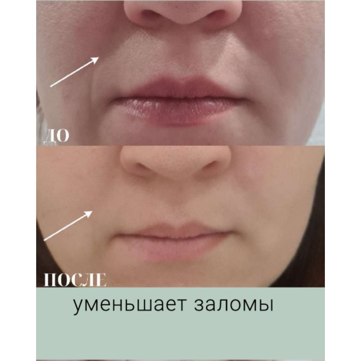 Бокс "Лифтинг" (9 продуктов) VIP НГ - ноябрь